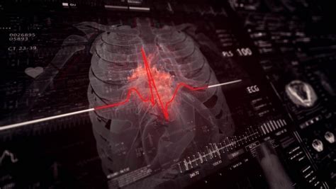 Image result for CT Scanning Machine Animation