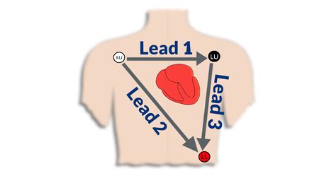 3-Lead ECG - Nursing Unraveled