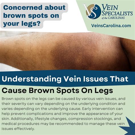 What Causes Brown Spots On Your Lower Legs - Infoupdate.org