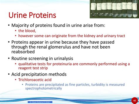 Protein In Urine Rheumatoid Arthritis at Vicki Howes blog