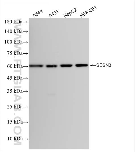 SESN3 antibody (84823-3-RR) | Proteintech
