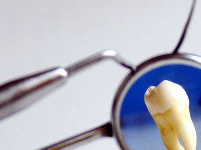 Shre Vinayakaa Dental Clinic ::. Jaynagar Bangalore India