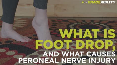 Peroneal Nerve Foot Drop