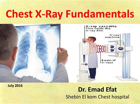 Image result for Chest X-Ray Tutorial
