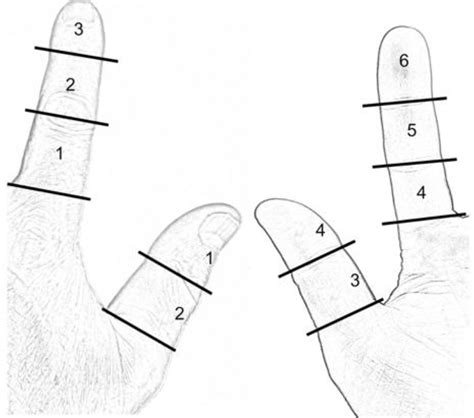 Regional anaesthesia on the finger: Traditional dorsal digital nerve ...