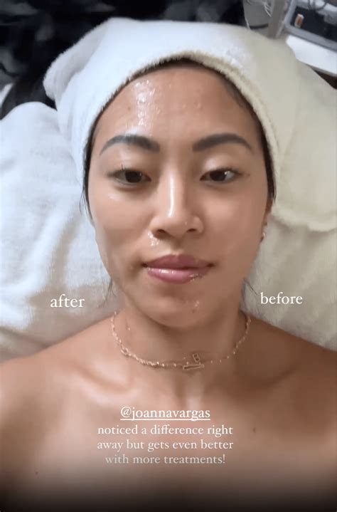 Image result for Microcurrent Technology