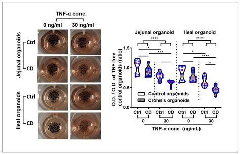 Epithelial Regeneration Ability of Crohn’s Disease Assessed Using ...
