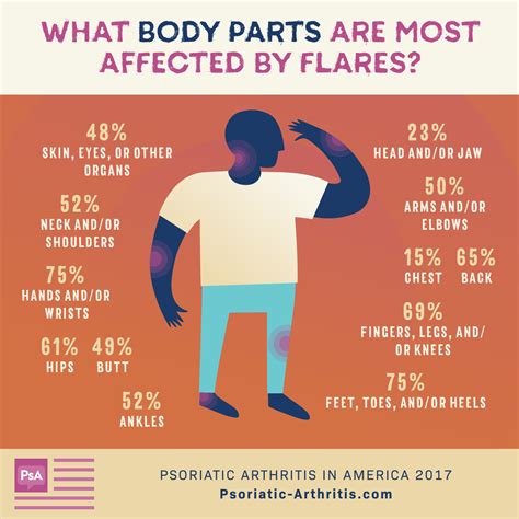 Psoriatic Arthritis Flare Up Causes at Aaron Edwards blog