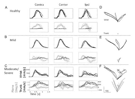 Image result for Compensatory Movement Examples