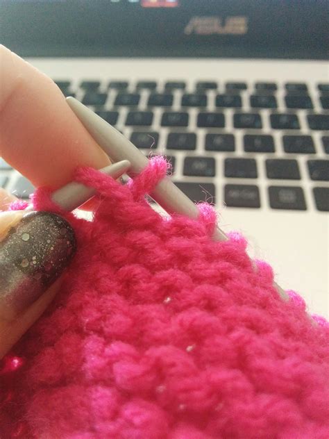 Image result for Surjet Simple Intradermique