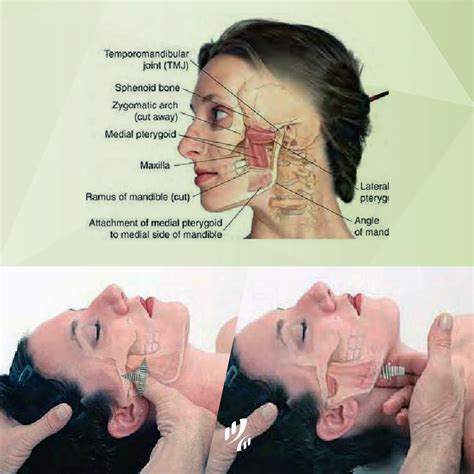 tight jaw muscles