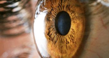 Dr. Swati Agarwal | Best Eye Clinic - LASIK & Cataract