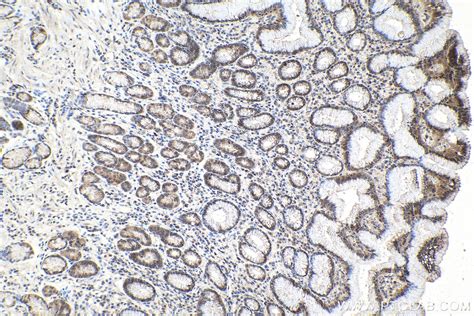 IHCeasy VHL Ready-To-Use IHC Kit KHC1592 | Proteintech