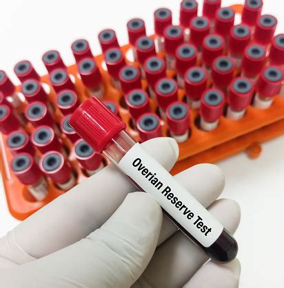 Image result for Ovary Function Test