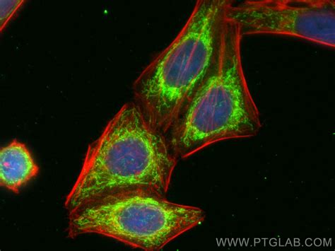 ACOT2 antibody (15633-1-AP) | Proteintech