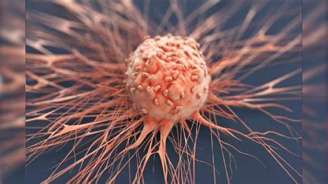 Prostate Cancer Early Symptoms : দেশত দ্ৰুতগতিত বাঢ়িছে প্ৰোষ্টেট ...