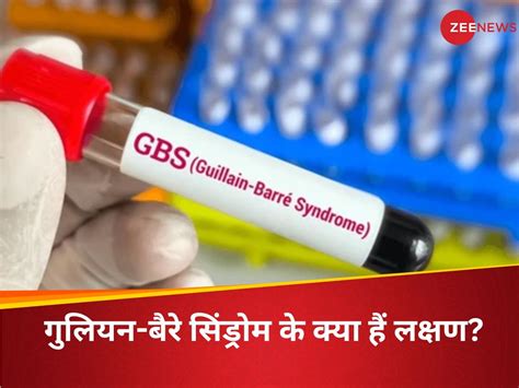 what is Guillain Barre Syndrome records suspected cases in pune know ...