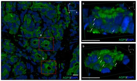 Molecular and Physiological Functions of PACAP in Sweat Secretion