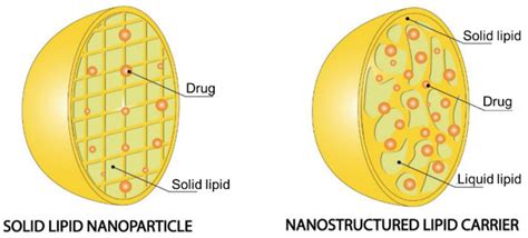 Solid Lipid Nanoparticles vs. Nanostructured Lipid Carriers ...