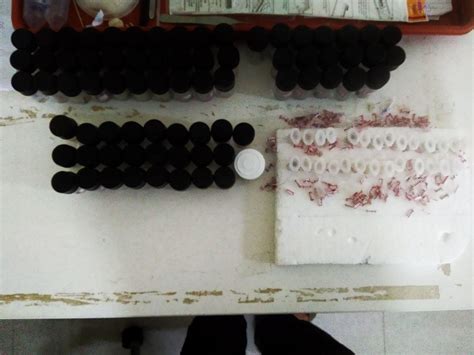 Biology Research: The curious case of the ant-mimicking spider - Azim ...