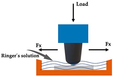 Scratch and Wear Behaviour of Co-Cr-Mo Alloy in Ringer’s Lactate Solution