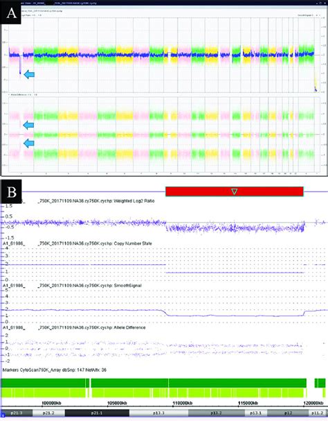 Image result for Copy Number Variation by SNP Array