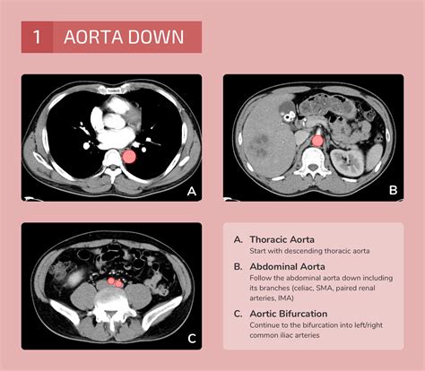 What Is A Ct Chest Abdomen And Pelvis at Bertha Arrington blog