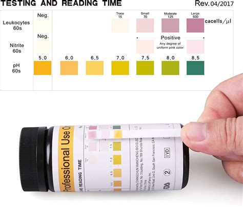 Blood In Urine Test Strips Results at Laura Mullen blog