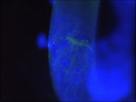 ZEISS SL Imaging Solution | ZEISS Medical Technology