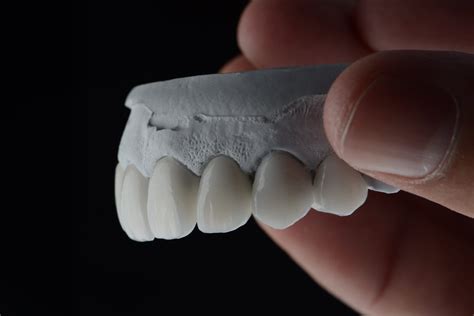 The Benefits of Using Digital Smile Design in Aesthetic Dentistry ...