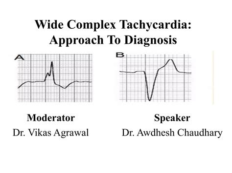 Approach to Wide complex tachycardia /cardiology | PPT