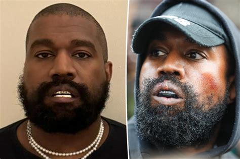Exclusive | Kanye West is 'weird' about his teeth, once had favorite ...