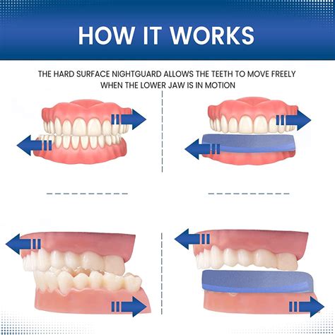 How To Make A Fake Mouth Guard at Toni Esser blog