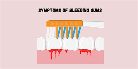 Bleeding Gums- Causes, Diagnosis, and Remedies - PUREXA Oral Care