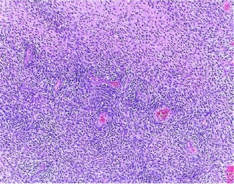 Spindle Shape 的图像结果
