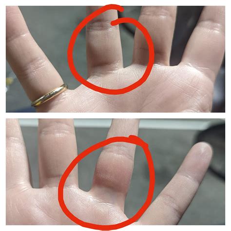 Image result for Left Hand Ring Finger