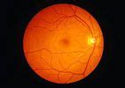 DRISHTI EYE CARE & PHACO CENTRE