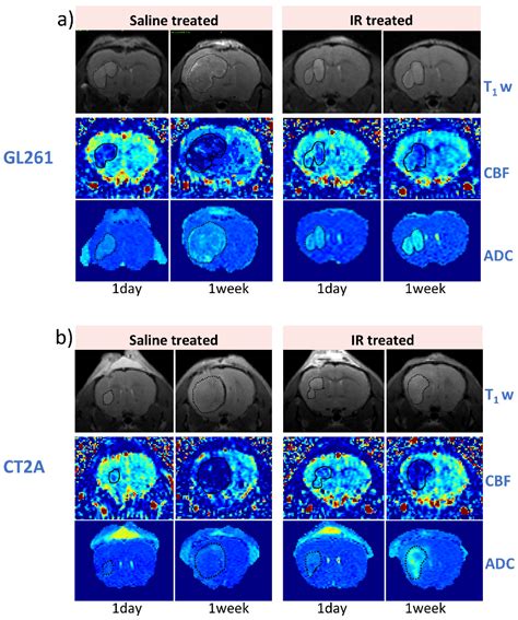Radiomic Profiling of Orthotopic Mouse Models of Glioblastoma Reveals ...