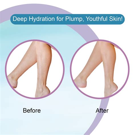 Hyaluronic Acid Body Lotion – Dr.Rashel