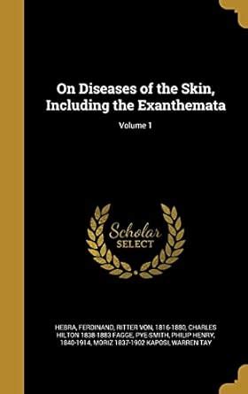 On Diseases of the Skin, Including the Exanthemata; Volume 1 : Hebra ...
