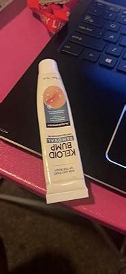 MOSKILA Keloid Bump Removal, Keloid Scar Treatment for Face, India | Ubuy