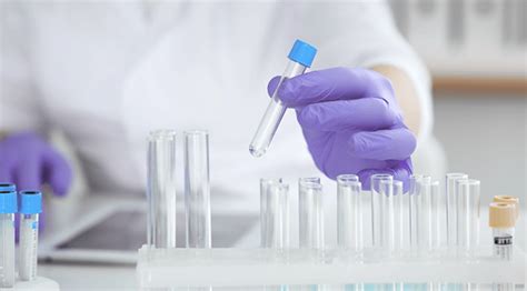 Image result for Visual Elisa Protocol