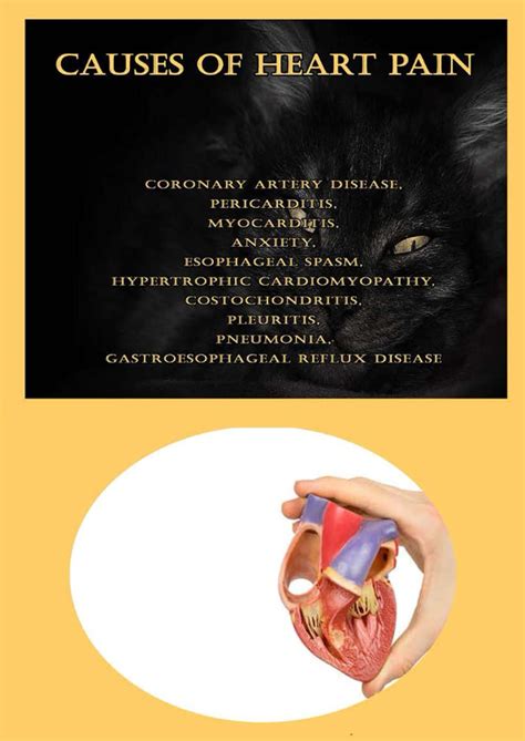 Buy Causes Of Heart Pain: Coronary Artery Disease, Pericarditis ...