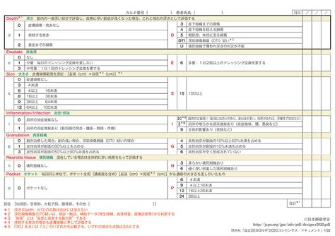 Image result for Sound Detection Module