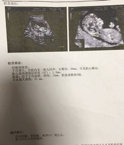 产科医生|怀孕11个月还不生，医生强行剖腹产让娃出生后，孕妈：我俩离婚吧