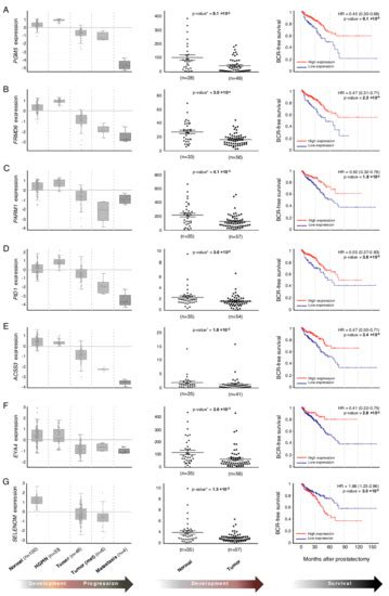 The Transcriptomic Landscape of Prostate Cancer Development and ...