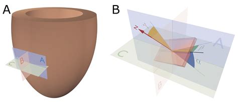 Assessing Myocardial Architecture: The Challenges and Controversies