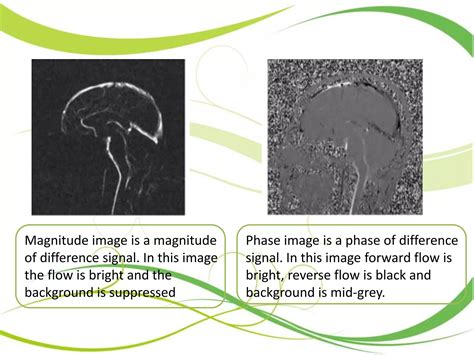 Image result for CSF Flow Test