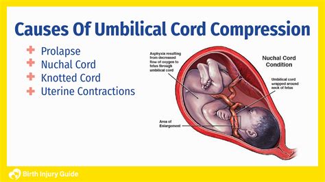 Stages Of Umbilical Cord at Sandra Mcgregor blog