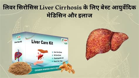Liver Diseases | Causes I Symptoms | Ayurvedic Medicine and Treatment